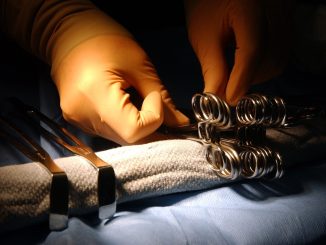 Σε εξέλιξη μεταμόσχευση ήπατος στο Ιπποκράτειο με λήπτη έναν 19χρονο