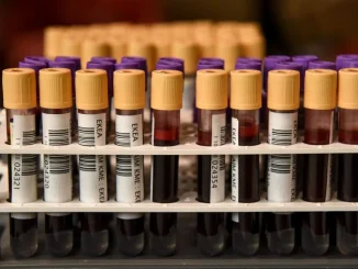 Δίνουμε αίμα και το καλοκαίρι – Εθελοντική αιμοδοσία στις 30 και 31 Ιουλίου στο μετρό Συντάγματος